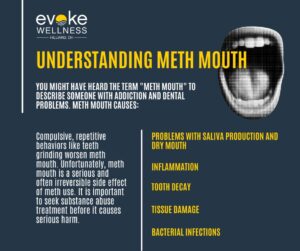 what are amphetamines infographic 